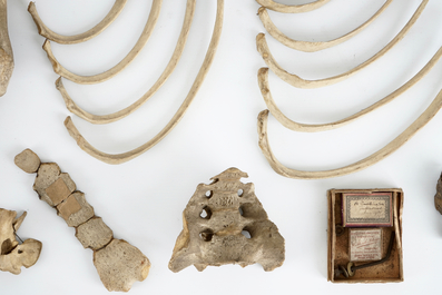 A collection of human bones from a doctor's office, 19th C.